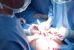 Британские хирурги удалили 8-килограммовую опухоль яичника
