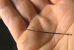 Нижегородские хирурги извлекли из сердца пациентки 5-сантиметровую швейную иглу
